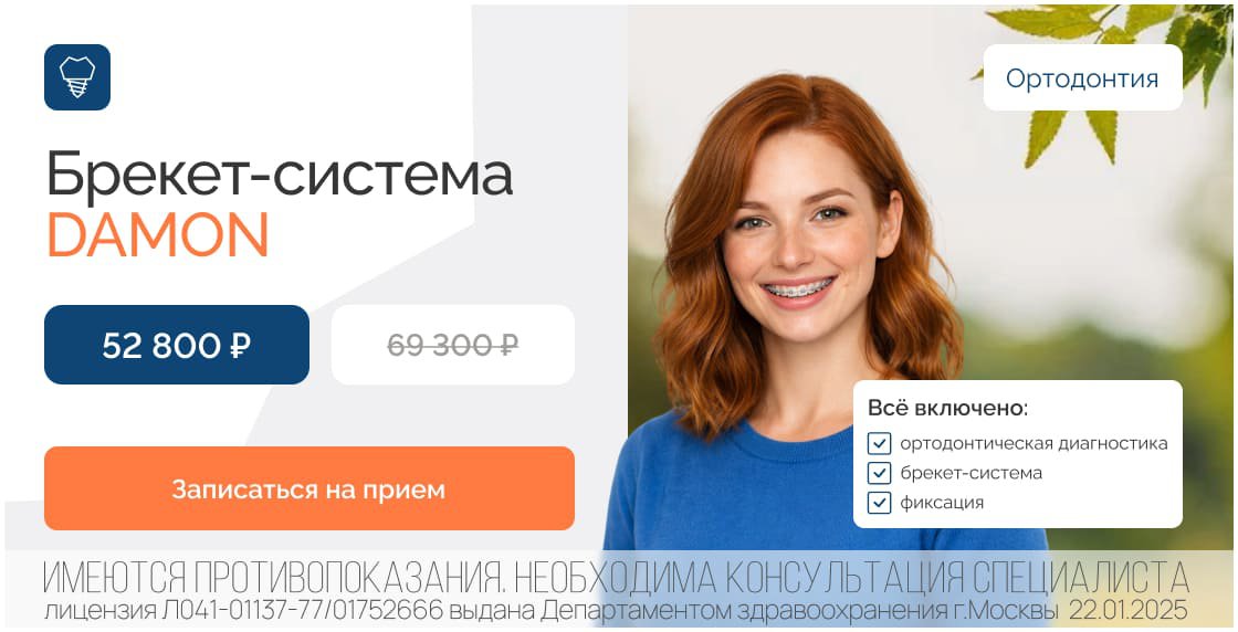 Акция: Установка брекет-системы DAMON на одну челюсть