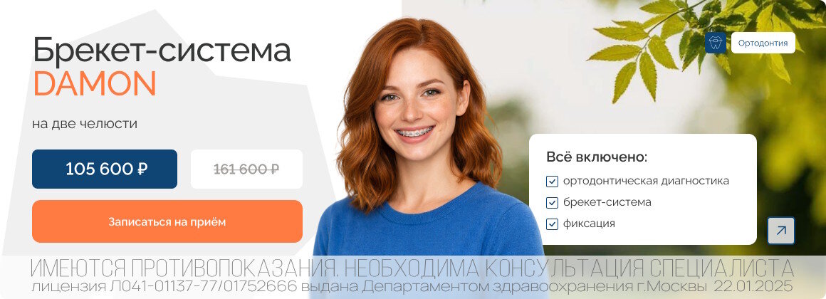 Акция: Установка брекет-системы DAMON на две челюсти