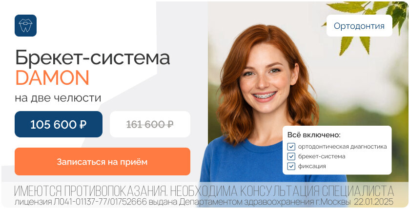 Акция: Установка брекет-системы DAMON на две челюсти